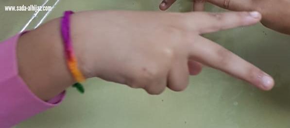 مستشفى الطوال العام يقيم فعالية اليوم العالمي للصحة النفسية بإبتدائية أم المؤمنين حفصة بالشعفولية