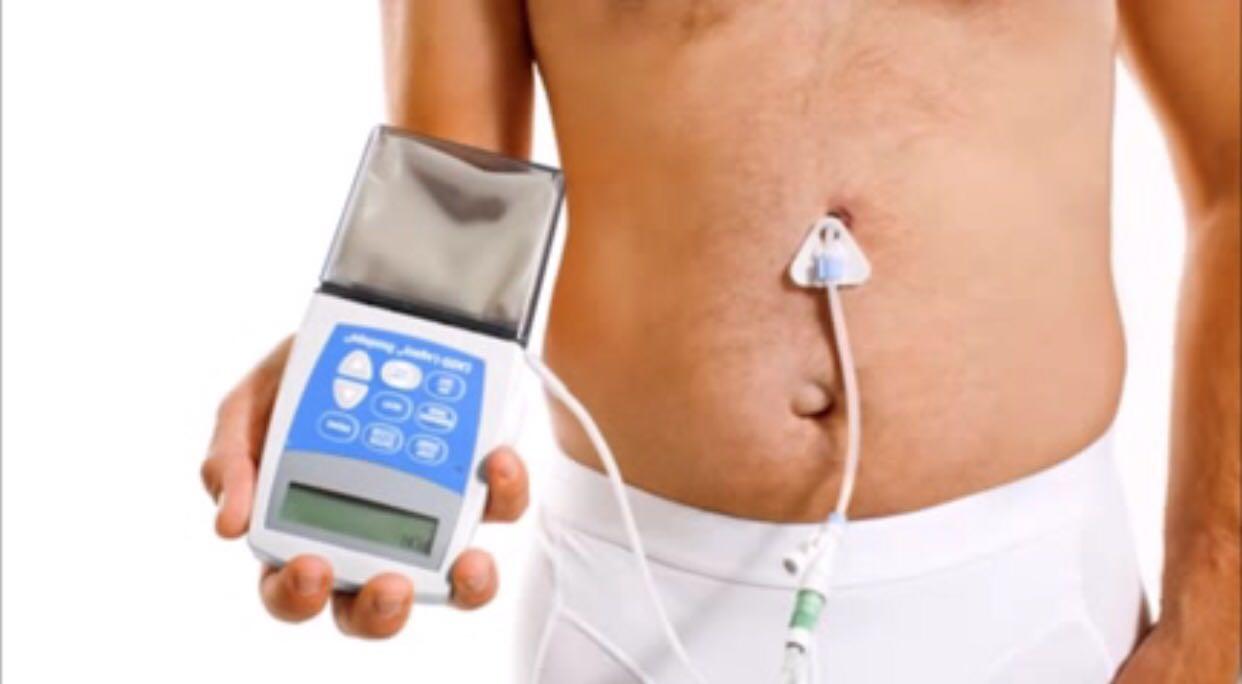 مستشفى الملك فهد بالمدينه المنوره يعيد لمريض ستيني النطق والحركه