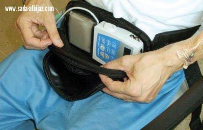 مستشفى الملك فهد بالمدينه المنوره يعيد لمريض ستيني النطق والحركه