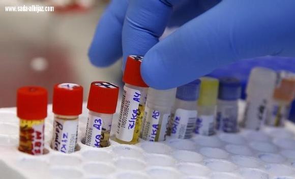 2237 متبرع بالدم واكثر من نصف مليون فحص مخبري منذ بداية الحج لليوم الثامن بمكة