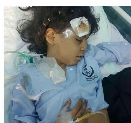 زينه جازان اصيبت بشظايا مقذوفه حوثي في الجمجمه ووالدها يناشد بعلاجها