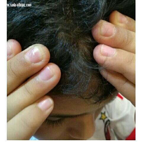 دم ولَيّ مشاجرة لطفلين بالمدينة تتصاعد بتعدٍّ وحشي من معلم والنهاية أمنية