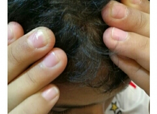 دم ولَيّ مشاجرة لطفلين بالمدينة تتصاعد بتعدٍّ وحشي من معلم والنهاية أمنية