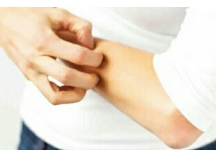 استشاري الجرب يمكن أن يصيب النظيفين وهو غير مخيف والعلاج في 3 أيام 