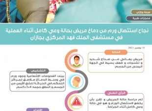 نجاح إستئصال ورم من دماغ مريض بحالة وعي كامل أثناء العملية في مستشفى الملك فهد المركزي بجازان