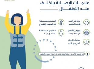 صحة جدة تحرص بنشر التوعية لمرض الجنف  بمناسبة اليوم العالمي لمرضى الجنف