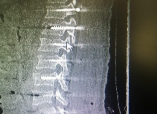 فريق طبي بمستشفى الملك عبدالعزيز يُنقذ حياة ثلاثيني سقط من الدور 5  