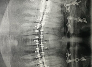تشكيل فريق طبي لمواجهة التشوهات الخلقية للفكين بمستشفى الملك فهد بالمدينة ونجاح 7 عمليات